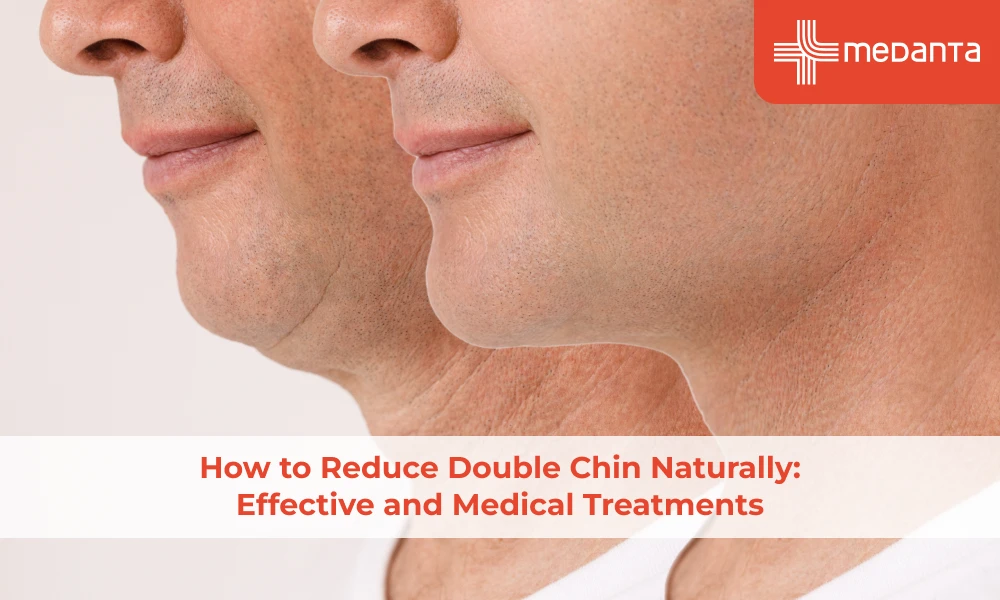 how-to-reduce-double-chin-naturally-effective-and-medical-treatments