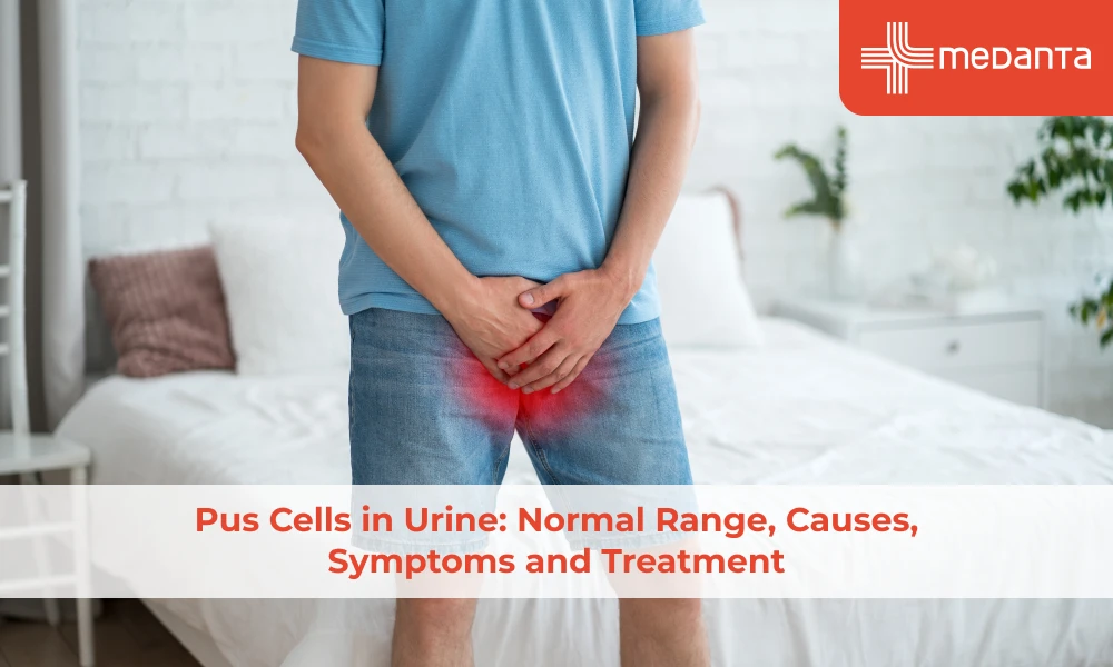 Pus Cells in Urine: Normal Range, Causes, Symptoms and Treatment