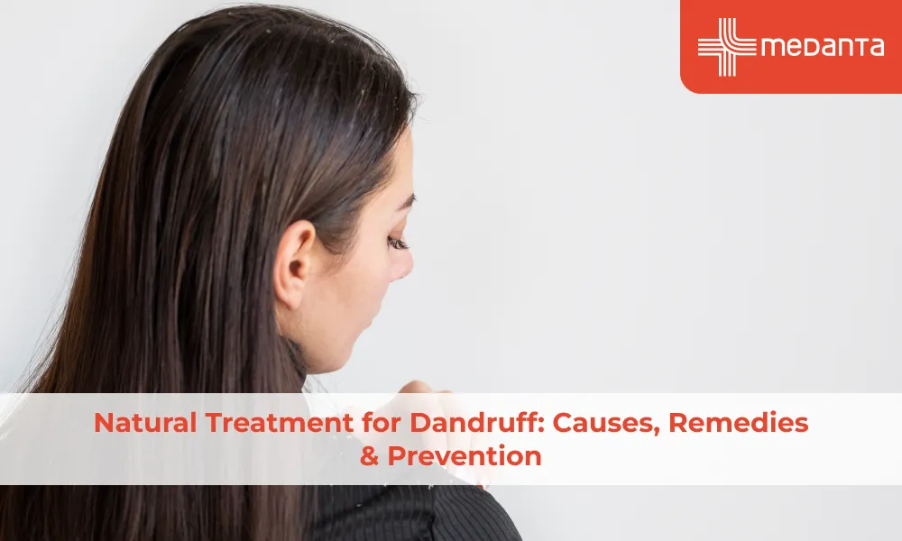 natural-treatment-for-dandruff-causes-remedies-prevention