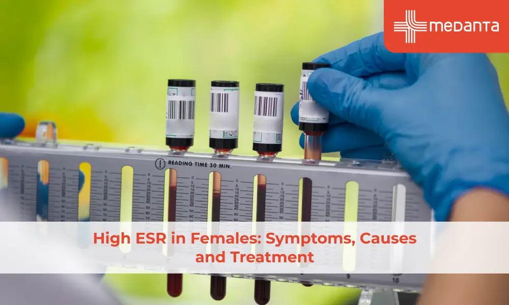 high-esr-in-females-symptoms-causes-and-treatment