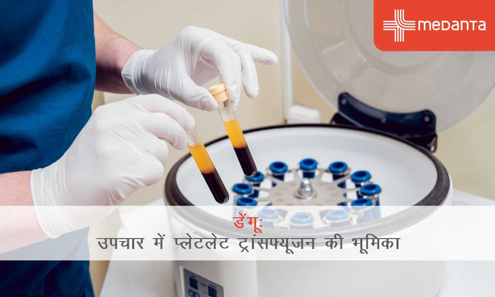 डेंगू उपचार में प्लेटलेट ट्रांसफ्यूजन की भूमिका