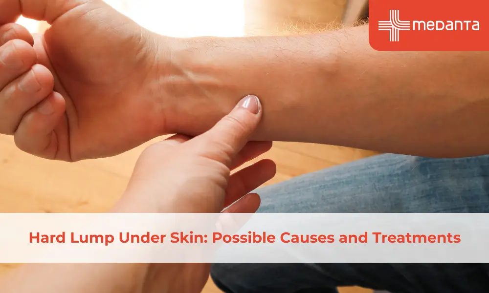 Hard Lump Under Skin: Possible Causes and Treatments