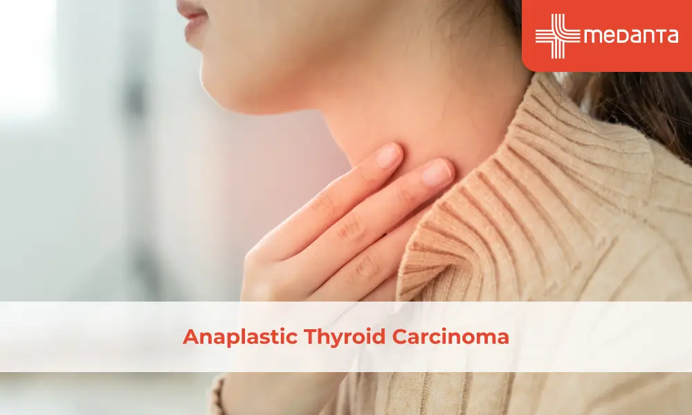Anaplastic Thyroid Carcinoma