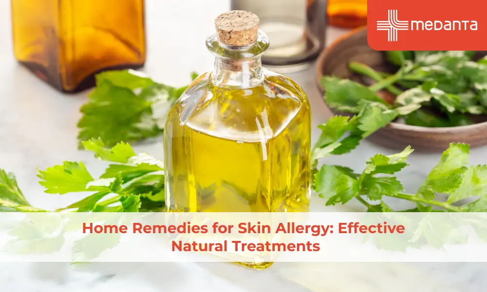Home Remedies for Skin Allergy: Effective Natural Treatments