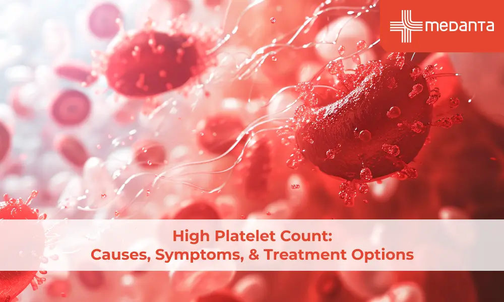 High Platelet Count: Causes, Symptoms, & Treatment Options