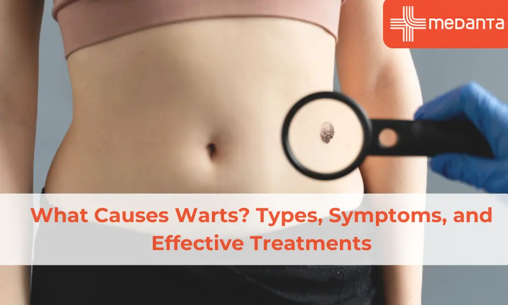 what-causes-warts-symptoms-treatment
