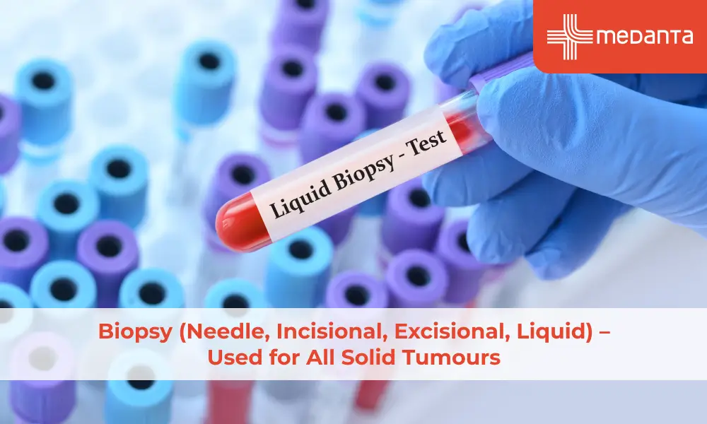 Biopsy (Needle, Incisional, Excisional, Liquid) – Used for All Solid Tumours