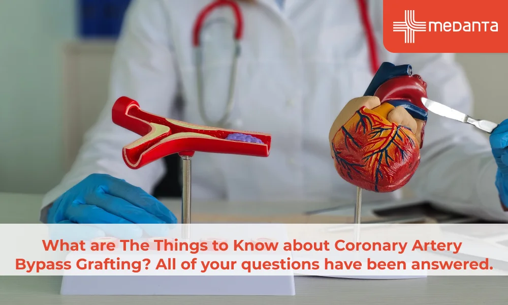 What are The Things to Know about Coronary Artery Bypass Grafting? All of your questions have been answered.