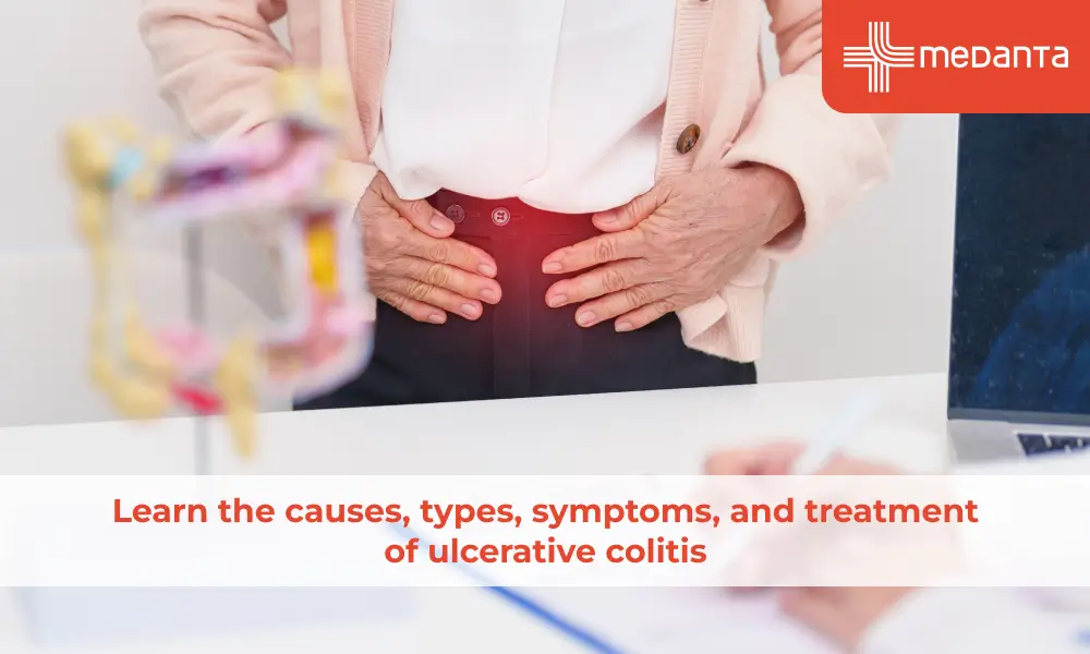 Learn the causes, types, symptoms, and treatment of ulcerative colitis