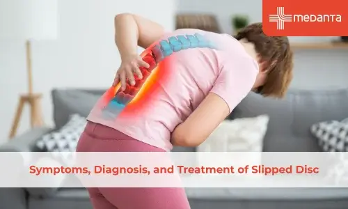 Symptoms, Diagnosis, and Treatment of Slipped Disc