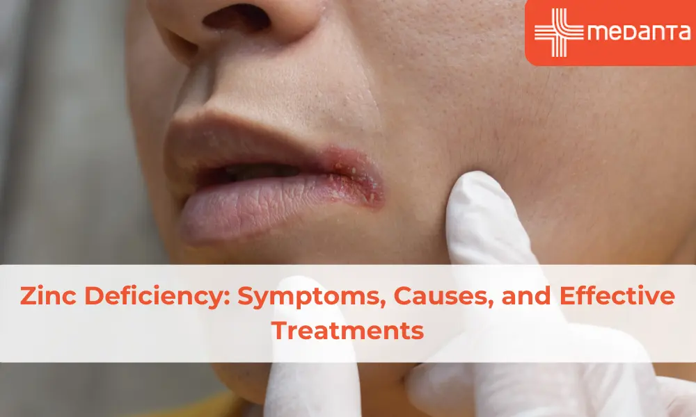 zinc-deficiency-symptoms-causes-and-effective-treatments