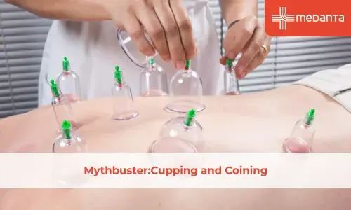 Mythbuster: Cupping and Coining
