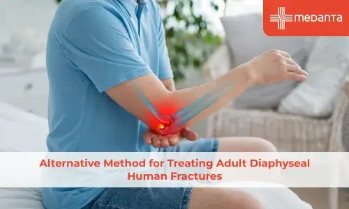 Alternative Method for Treating Adult Diaphyseal Human Fractures