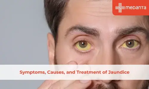Symptoms, Causes, and Treatment of Jaundice