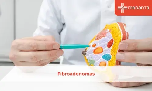 Fibroadenomas