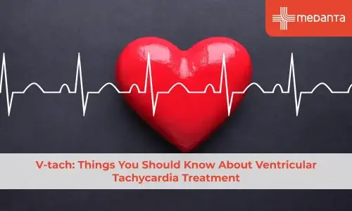 V-tach: Things You Should Know About Ventricular Tachycardia Treatment