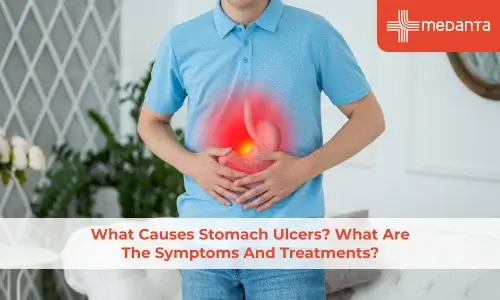 What Causes Stomach Ulcers? What Are The Symptoms And Treatments?