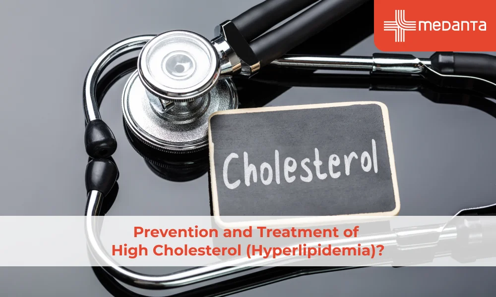 Prevention and Treatment of High Cholesterol (Hyperlipidemia)?
