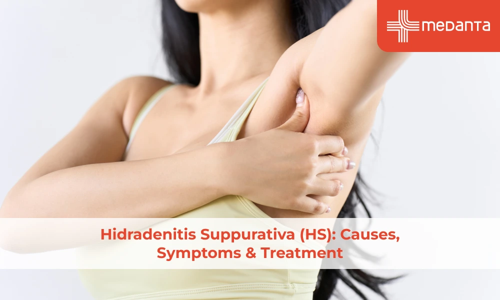 Hidradenitis Suppurativa (HS): Causes, Symptoms & Treatment