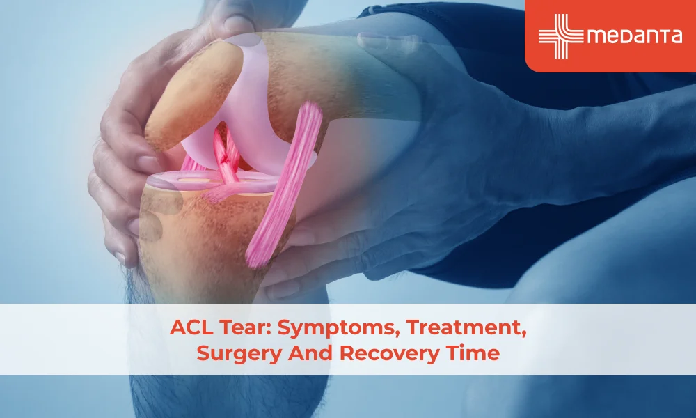 acl-tear-symptoms-treatment-surgery-and-recovery-time