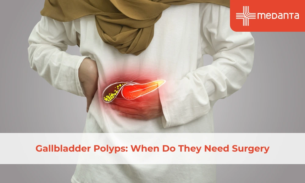 gallbladder-polyps-when-do-they-need-surgery