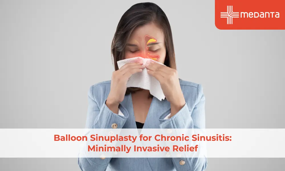 balloon-sinuplasty-for-chronic-sinusitis-minimally-invasive-relief
