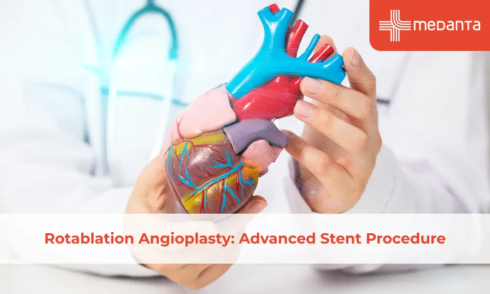rotablation-angioplasty-advanced-stent-procedure