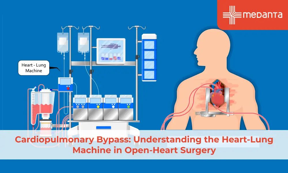 cardiopulmonary-bypass-understanding-the-heart-lung-machine-in-open-heart-surgery