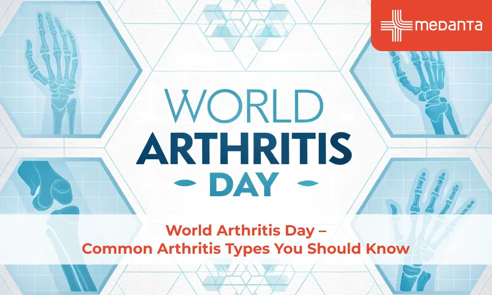 World Arthritis Day – Common Arthritis Types You Should Know