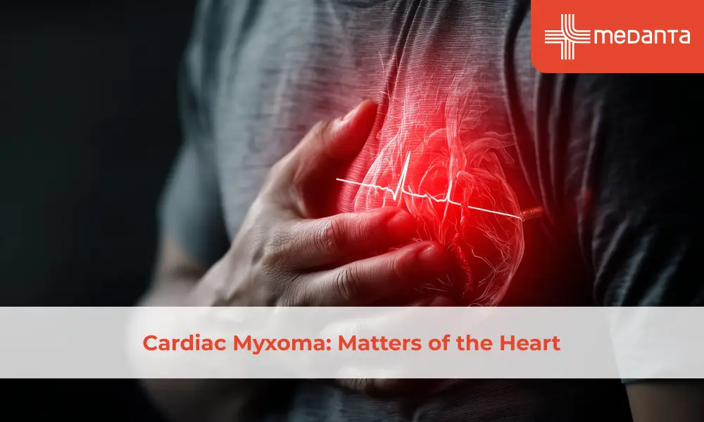 Cardiac Myxoma: Matters of the Heart