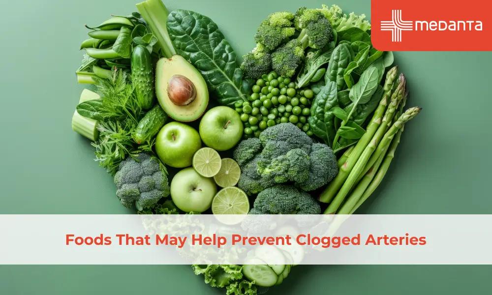 Foods That May Help Prevent Clogged Arteries