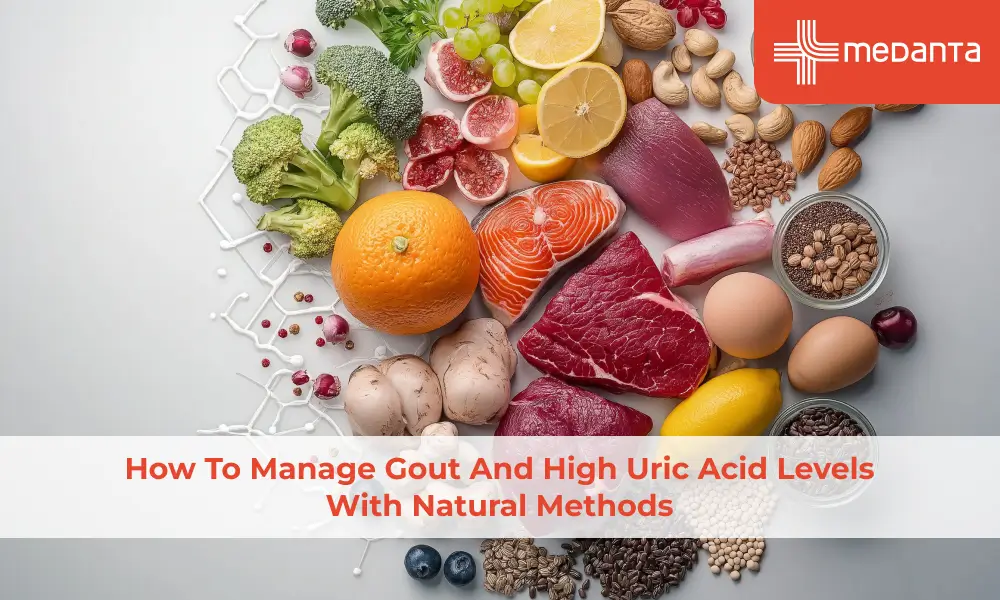 How To Manage Gout And High Uric Acid Levels With Natural Methods