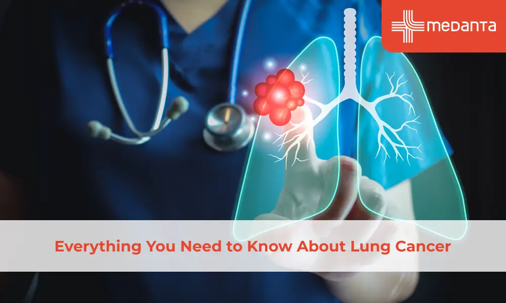 Everything You Need to Know About Lung Cancer