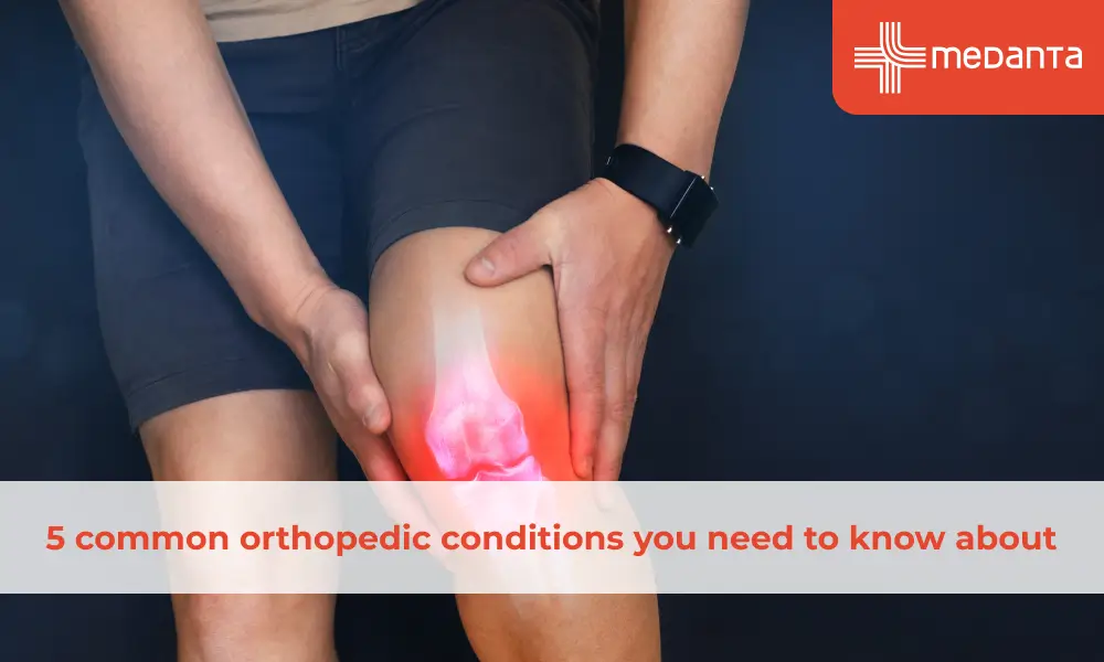 5 common orthopedic conditions you need to know about