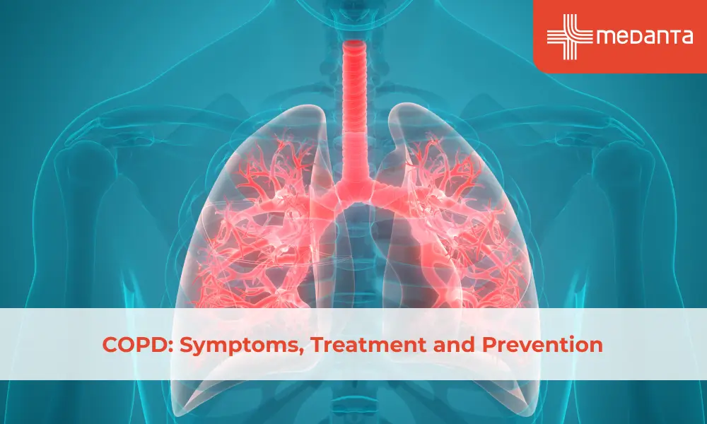 COPD: Symptoms, Treatment and Prevention