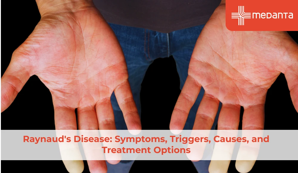raynauds-disease-symptoms-triggers-causes-and-treatment-options