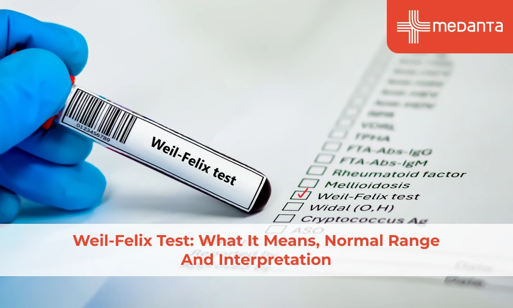 Weil-Felix Test: What It Means, Normal Range and Interpretation