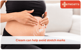 Cream can help avoid stretch marks