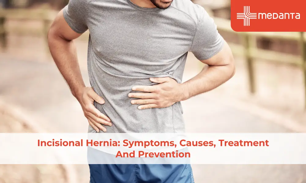 Incisional Hernia: Symptoms, Causes, Treatment and Prevention
