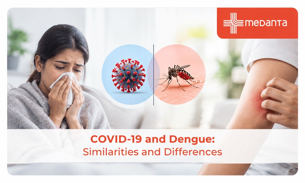 COVID-19 and Dengue