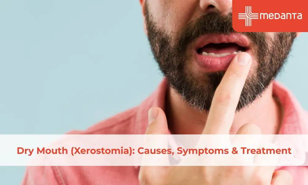Dry Mouth (Xerostomia): Causes, Symptoms & Treatment