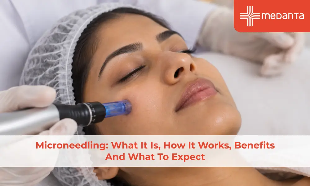 microneedling-what-it-is-how-it-works-benefits-and-what-to-expect