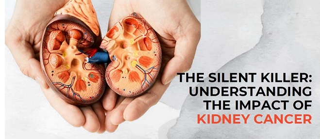 kidney cancer