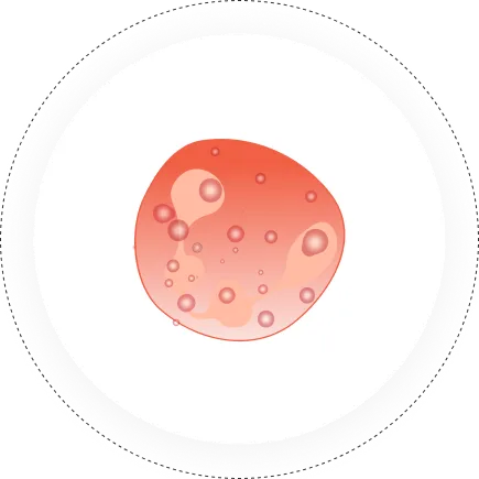 Haematology