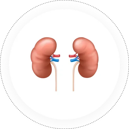 Kidney Transplant 