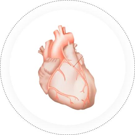 Interventional Cardiology
