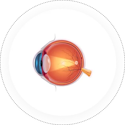 Ophthalmology