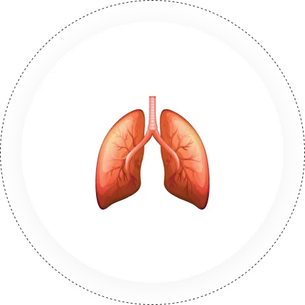Lung Transplant