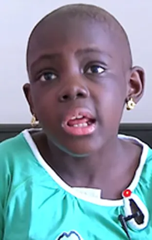Sickle Cell Anaemia