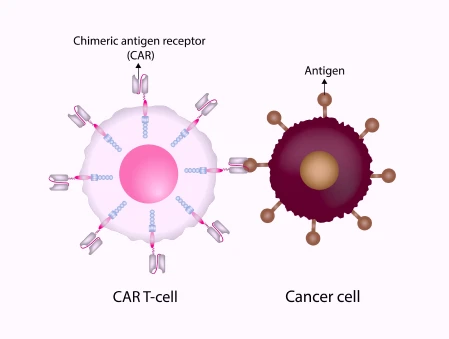 CAR T Cell Therapy